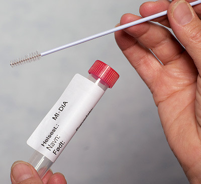 Figur 1  Prøven tas med en myk børste (Cytobrush Plus, Medscand, Medical, Sverige) som børstes 15 – 20 ganger opp og ned på…