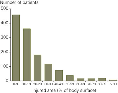 Figure 2 Number of patients 1984 - 2004, by injured skin area