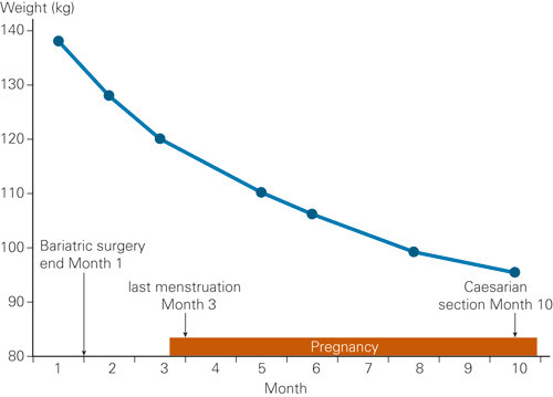 Figure 1  The patient’s weight development