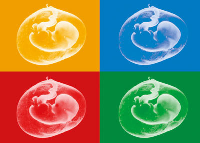 Illustrasjonsfoto Science Photo Library/GV-Press/NordicPhotos