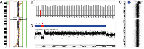 Figur 5  Ved kromosombasert HR-CGH-analyse av DNA fra en pasient med klinisk mistanke om et sjeldent syndrom ble en…