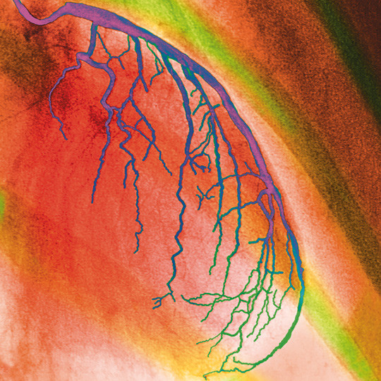 Illustrasjonsfoto: Science Photo Library