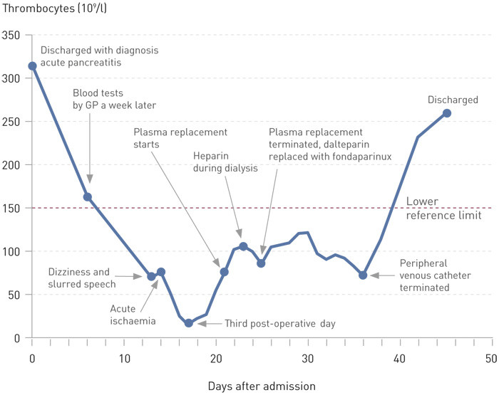 Figure 3  Thrombocyte values from initial discharge (Day 0) and until the patient is discharged for the third time, 45 days…