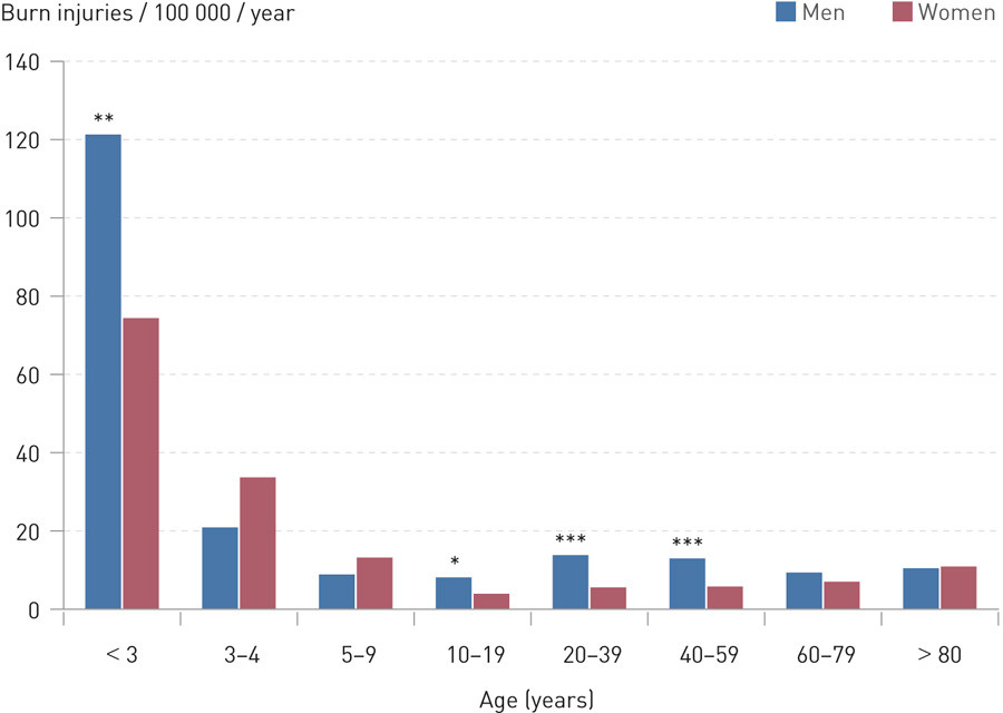Figure 2 Age-adjusted incidence of patients with burn injuries admitted to Norwegian hospitals in 2012. Based on data…