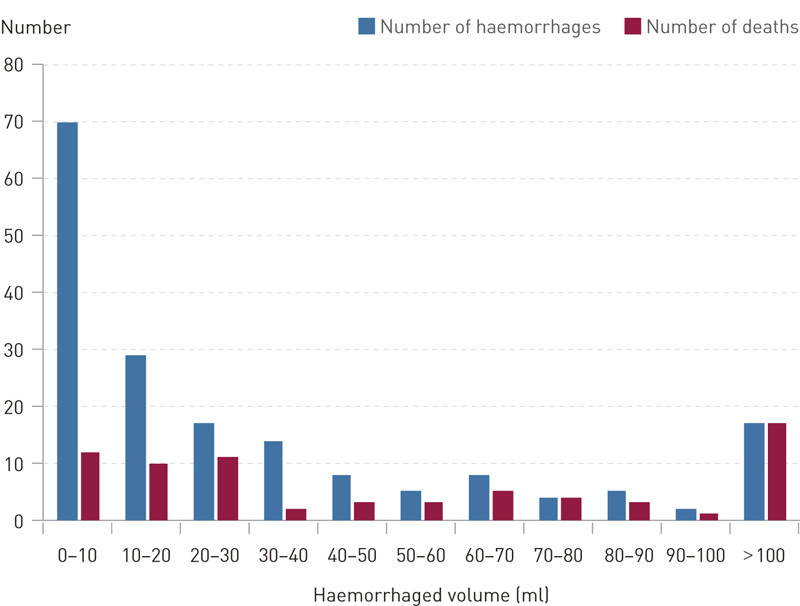 Figure 1 Haemorrhaged volume in ml measured by a CT scan upon admission and 90-day mortality in persons with a first-time…