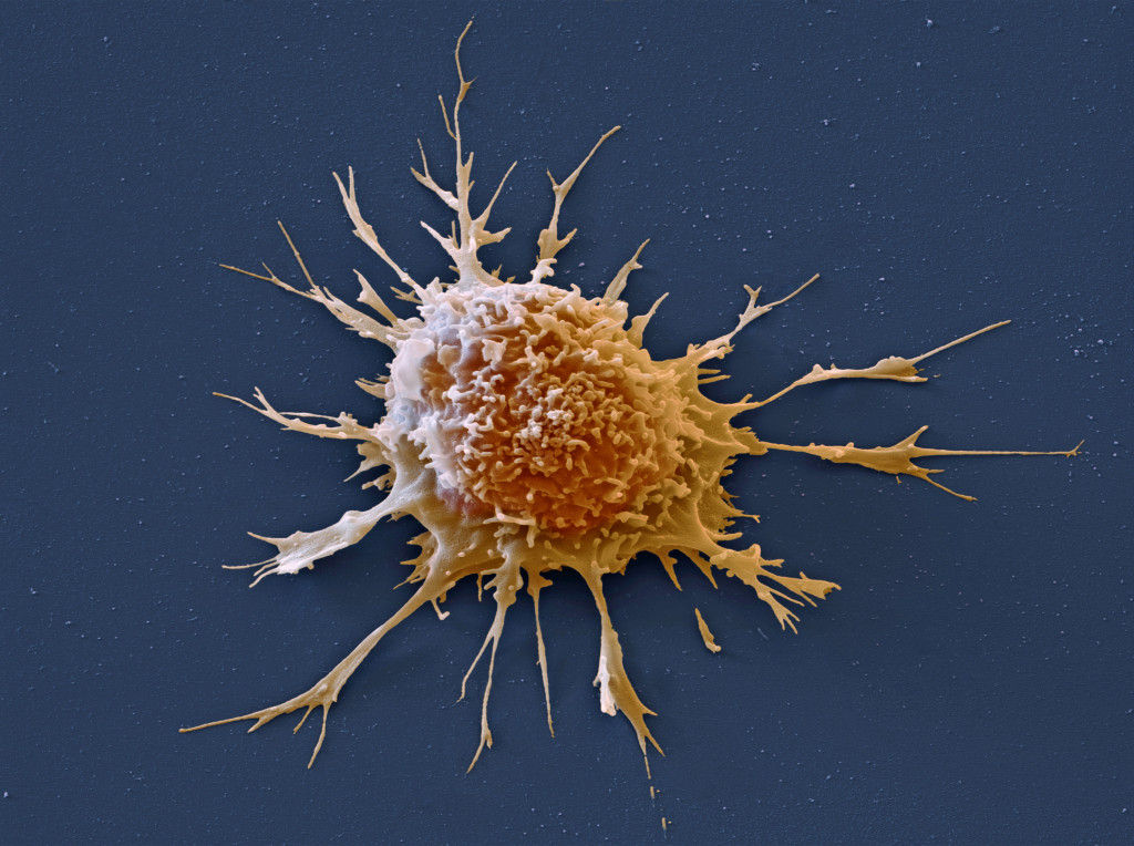 Illustrasjonsfoto: Science Photo Library
