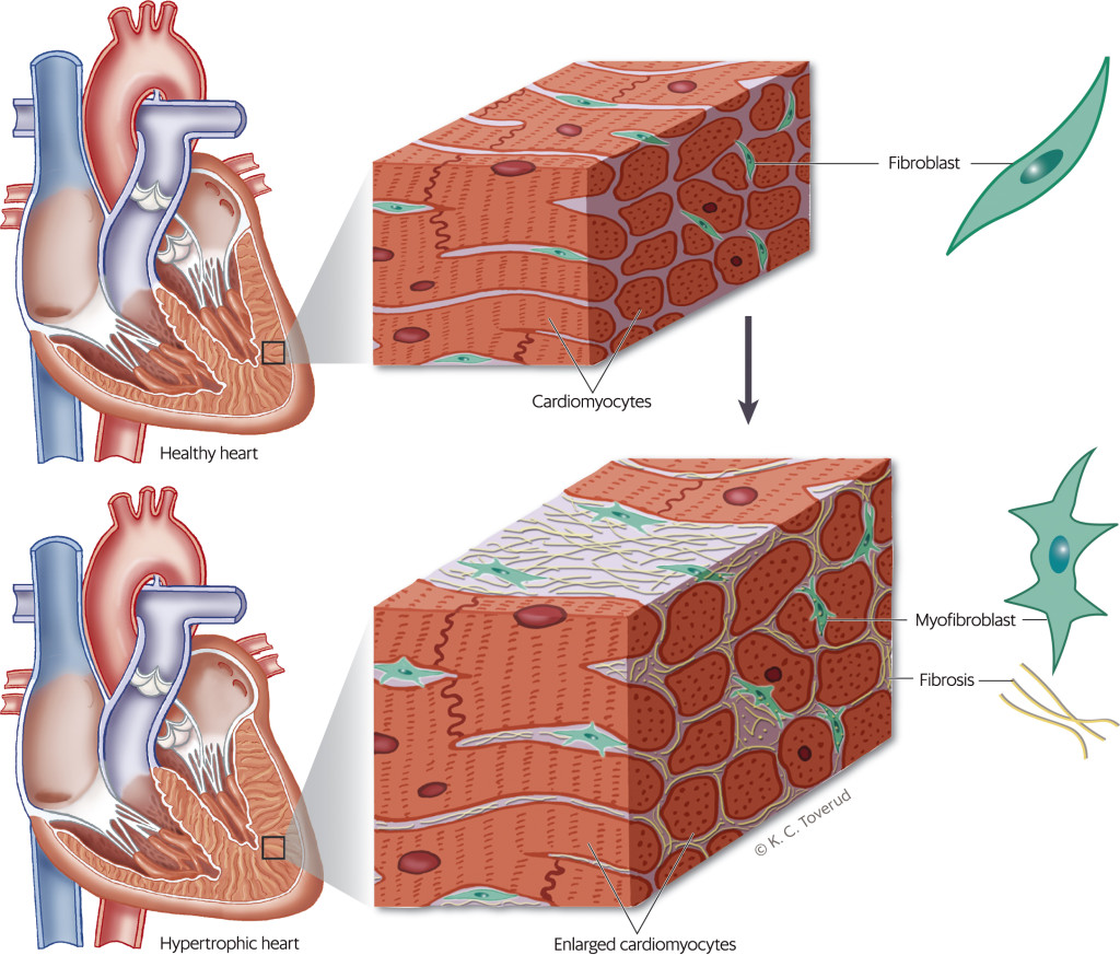 Figure 2 Fibroblasts are located among cardiomyocytes, where they ensure the correct quantity and composition of…