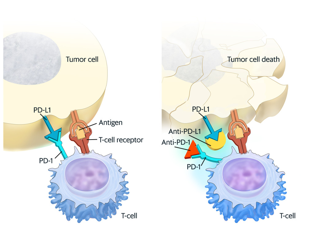Figure 1 When PD-L1 (programmed cell death ligand 1) on the tumour cell binds to the PD-1 receptor (programmed cell death 1…