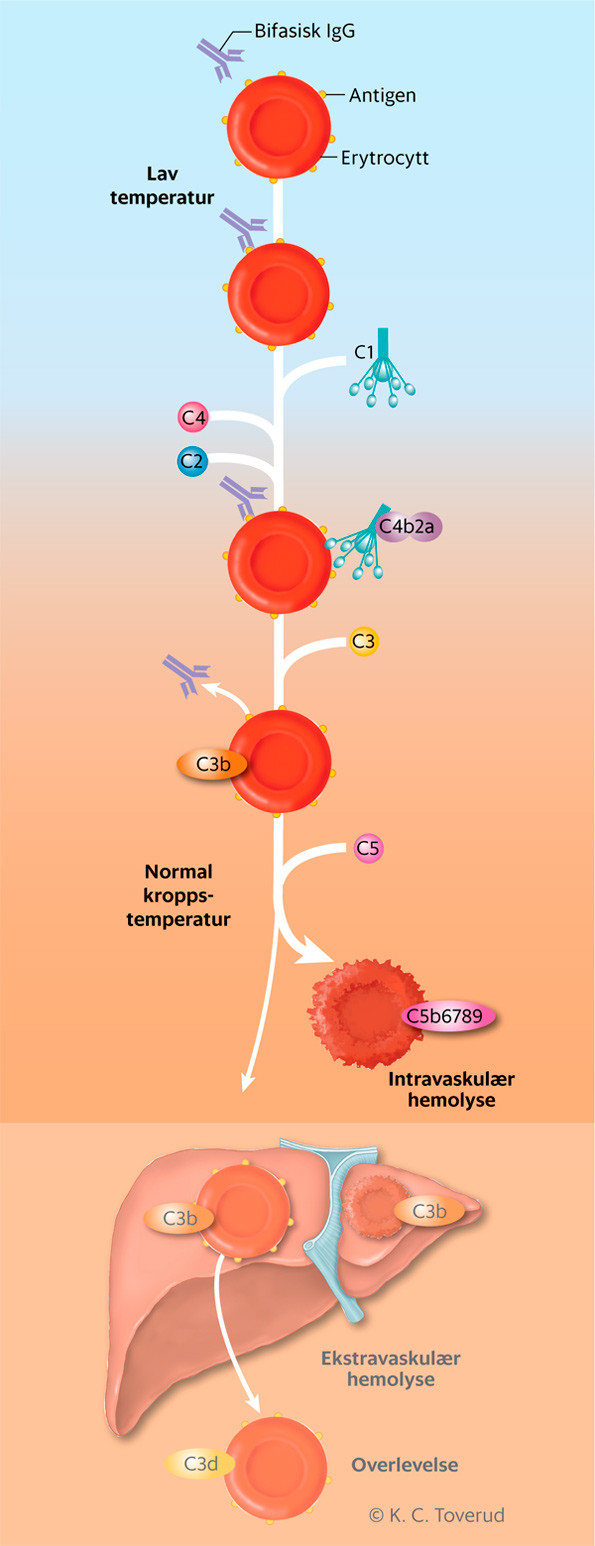 Figur 3 Komplementmediert hemolyse indusert av bifasisk IgG (Donath-Landsteiners antistoff). Ved temperatur under normal&hellip;