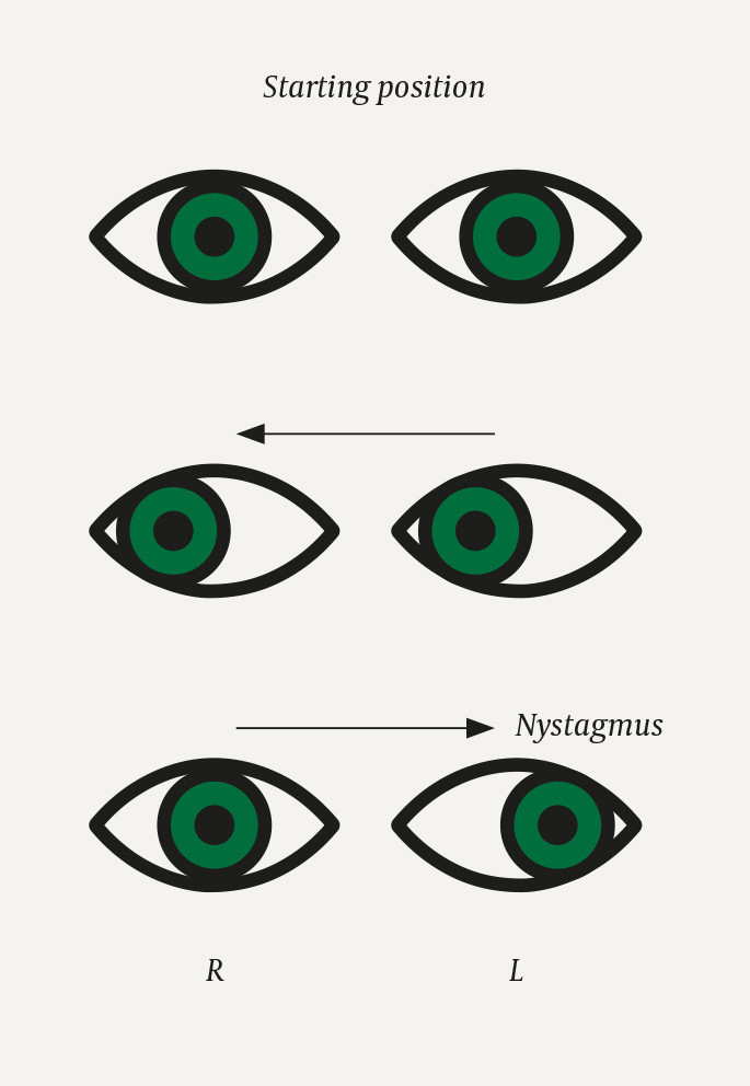 TEXT眼科学 = OPHTHALMOLOGY Kanski's Clinical Ophthalmology - 9780443110993 | Elsevier