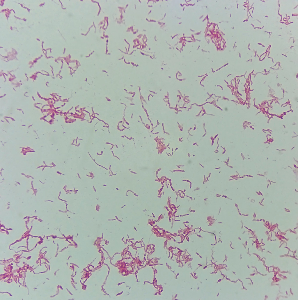 Figure 2 Gram-stained preparation of Streptobacillus moniliformis showing the pleomorphic appearance of the bacterium. Note…