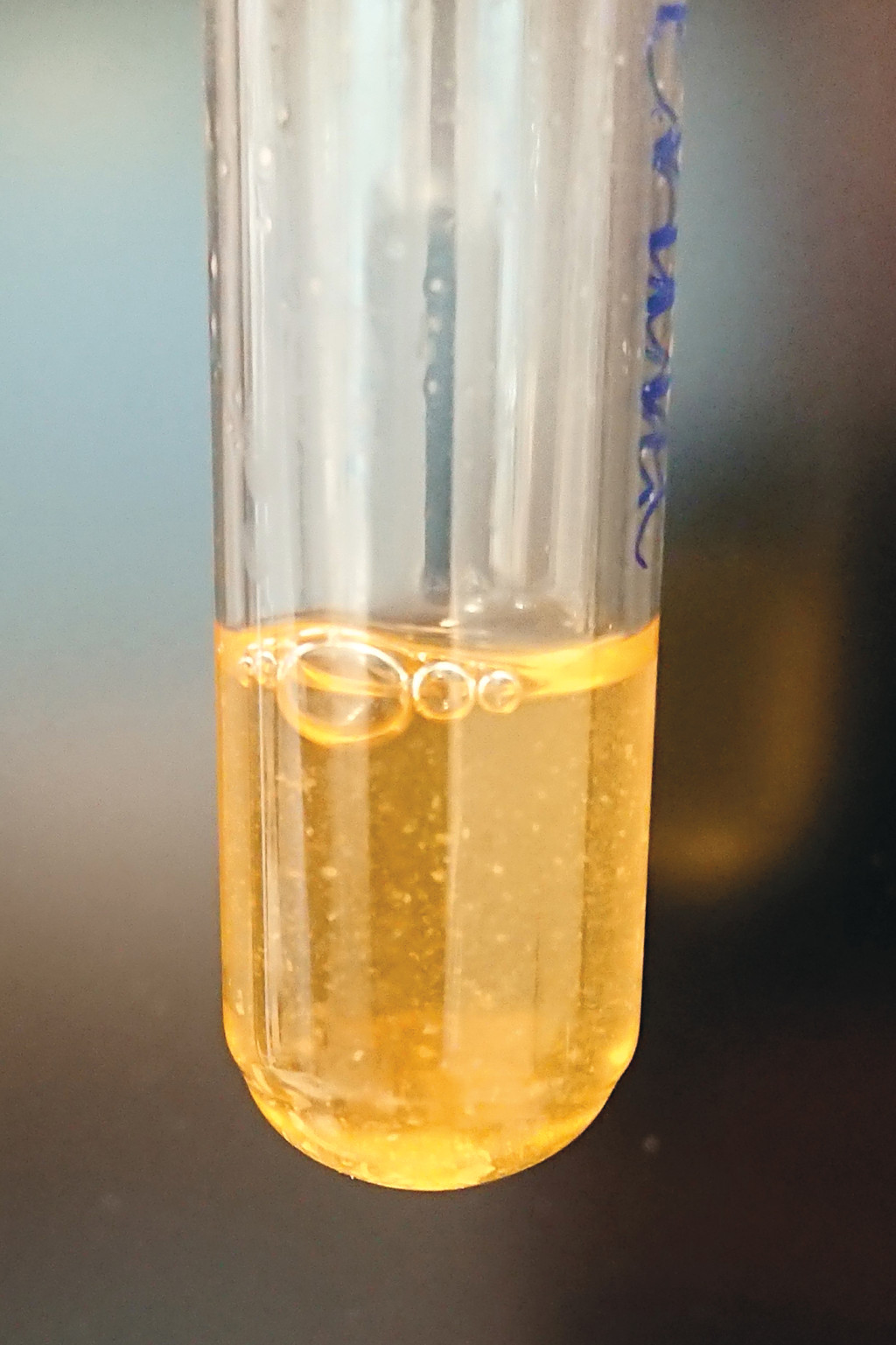 Figure 3 Streptobacillus moniliformis in the growth medium BHI (brain-heart infusion) broth supplemented with 10 % horse…