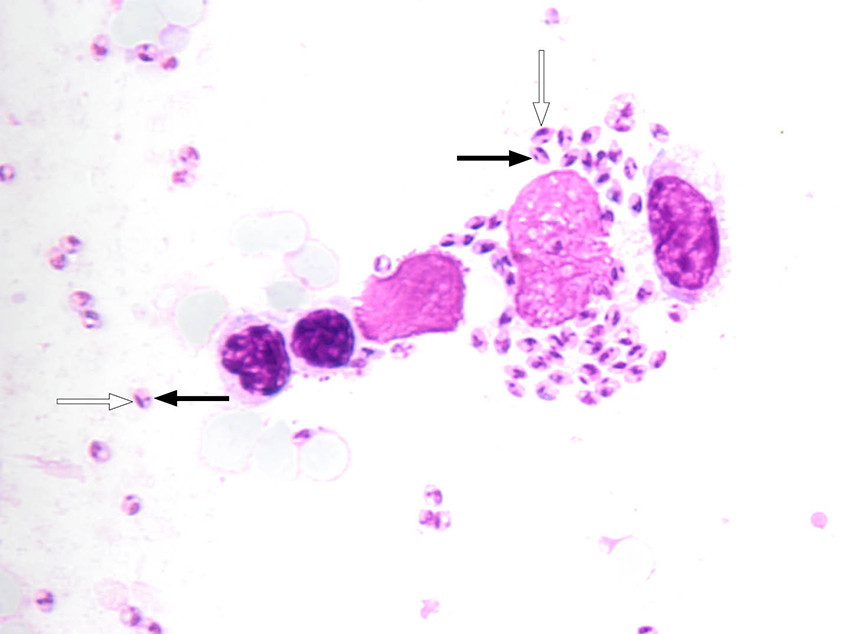 Figure 1 Light microscopy of spleen biopsy from patient with Leishmania amastigotes, in which the cell nucleus can be seen …
