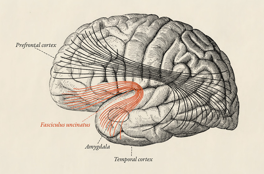 Figur 2 Fasciculus uncinatus er den siste banen i hjernen som myeliniseres, en prosess som ikke er ferdig før personen er i…