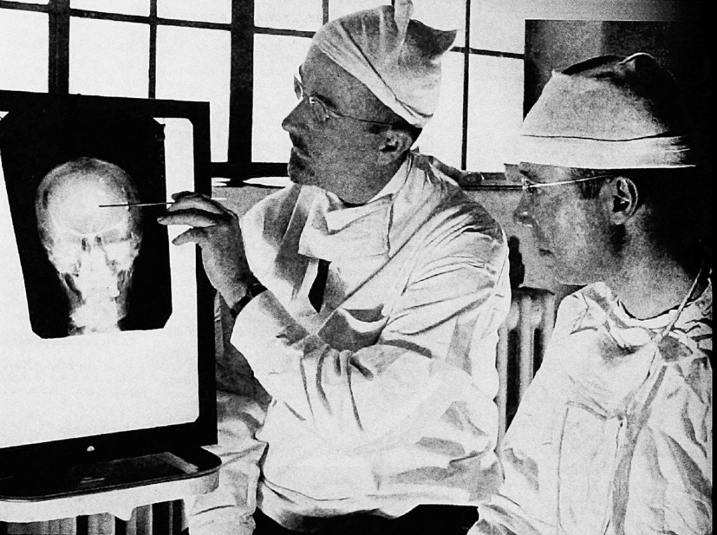 Figur 1 Dr. Walter Freeman II (t.v.), og Dr. James W. Watts studerer et røntgenbilde før en operasjon (2). Foto: Public…