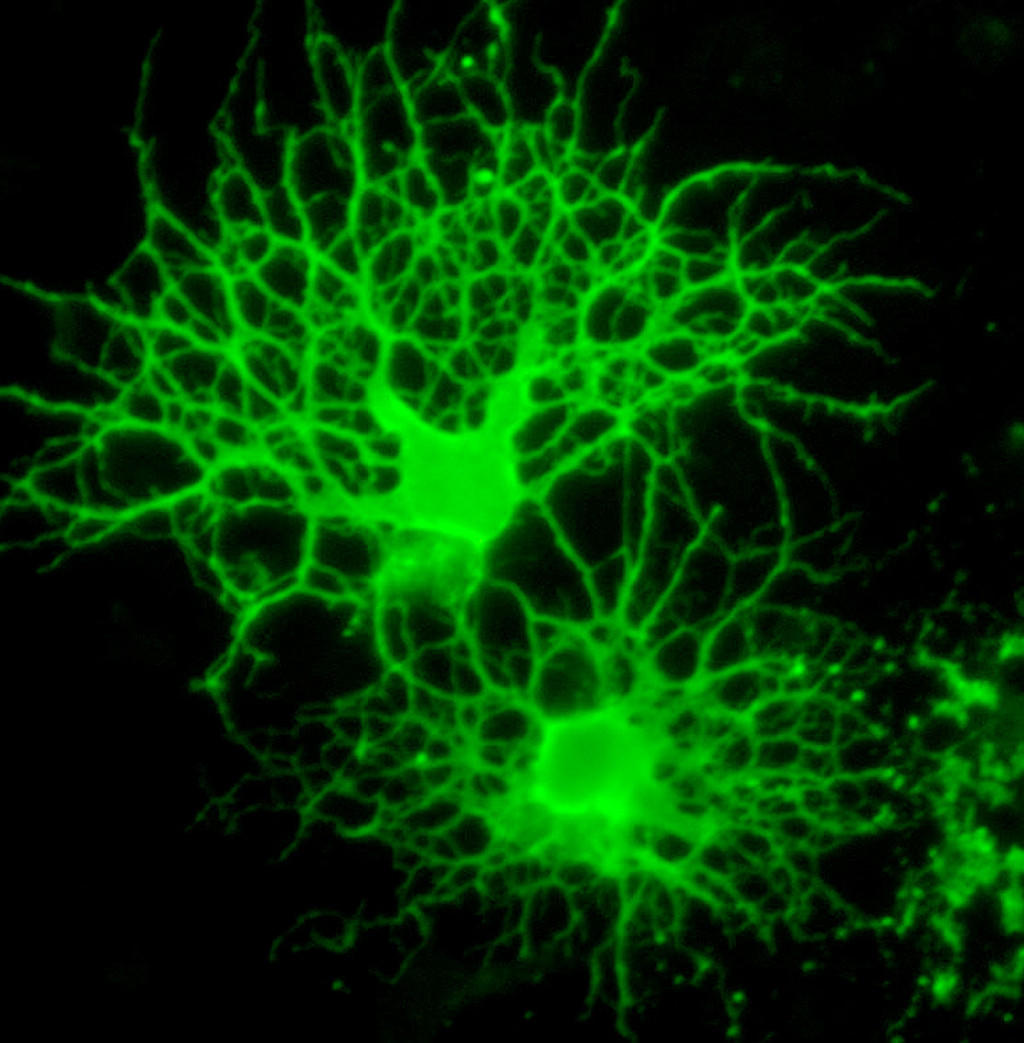 Illustrasjonsfoto: Oligodendrocytter. Science Photo Library / NTB