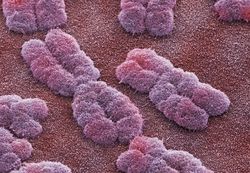 Farget elektronmikrografi (SEM) av kromosomer hos menneske. Foto: Science Photo Library / NTB