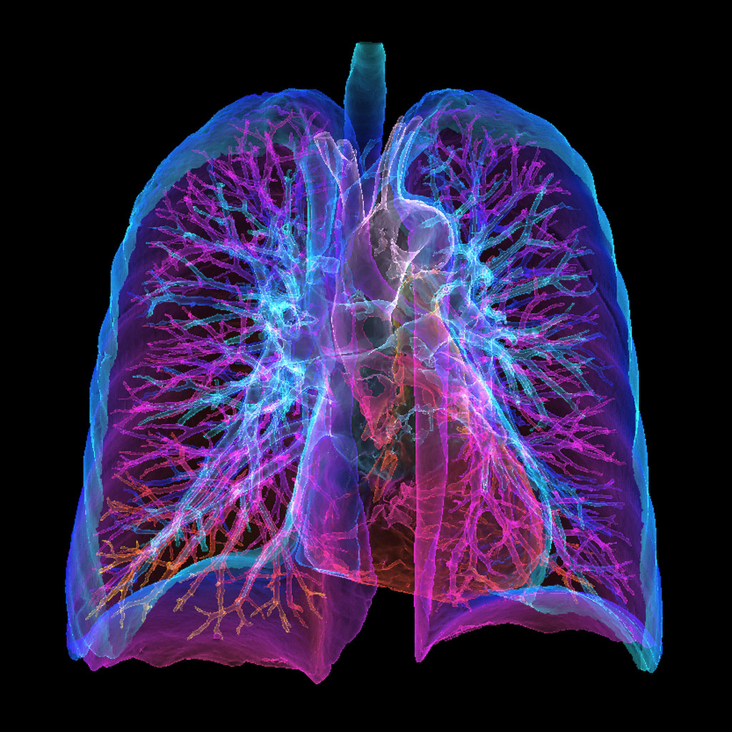 Hjerte og lunge 3D-fremstilt ved CT-fargeskanning (sett forfra). Illustrasjonsfoto: Science Photo Library / NTB