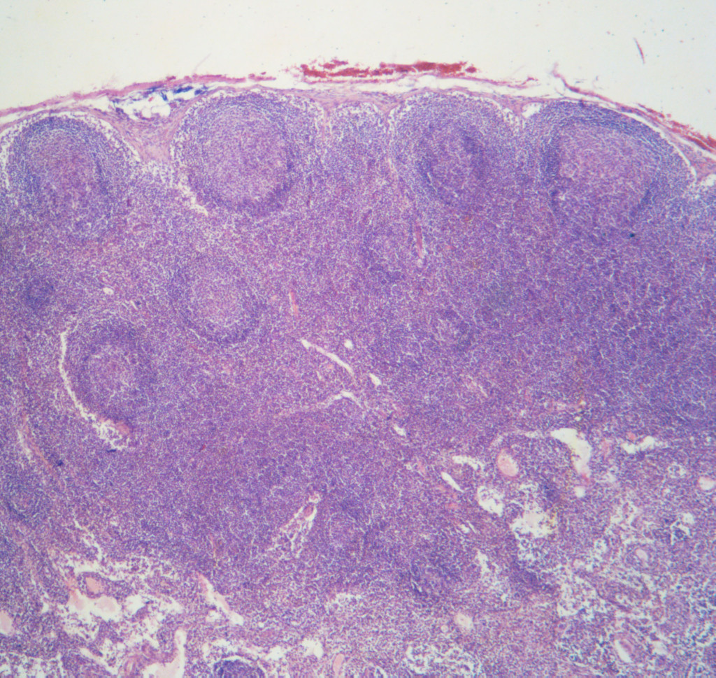 Lymfeknute, utsnitt fra hematoksylin-eosin-farget preparat som fra toppen og nedover viser kapsel, cortex med follikler,…
