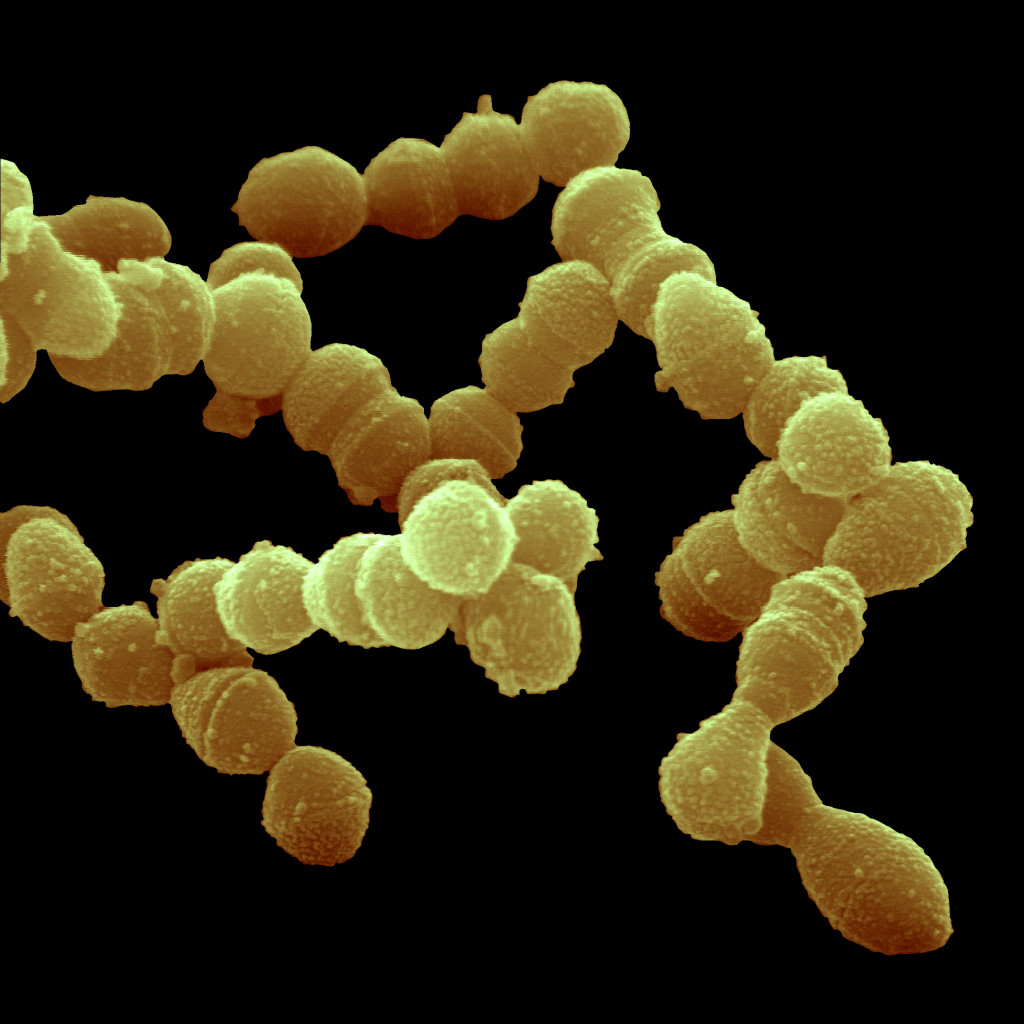  Streptococcus pneumoniae, skanningelektronmikroskopi (SEM). Foto: Science Photo Library / NTB 