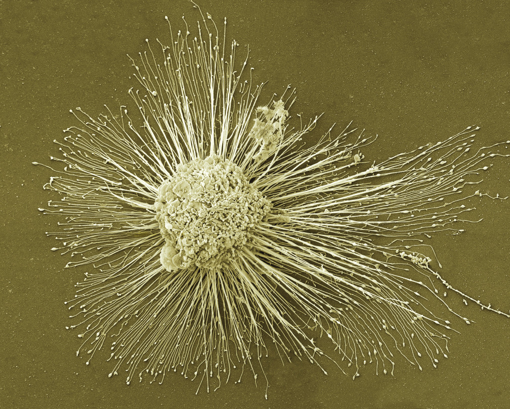 Farget skanningelektronmikroskopi (SEM) av en indusert pluripotent stamcelle (magnifikasjon: ×2500). Foto: Science Photo…