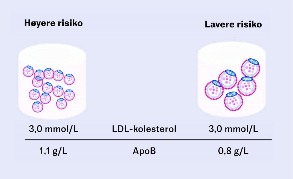 Figur 2 Hypotetisk illustrasjon av to pasienter med likt nivå av LDL-kolesterol, men ulik partikkelmengde (apoB). Pasienten…