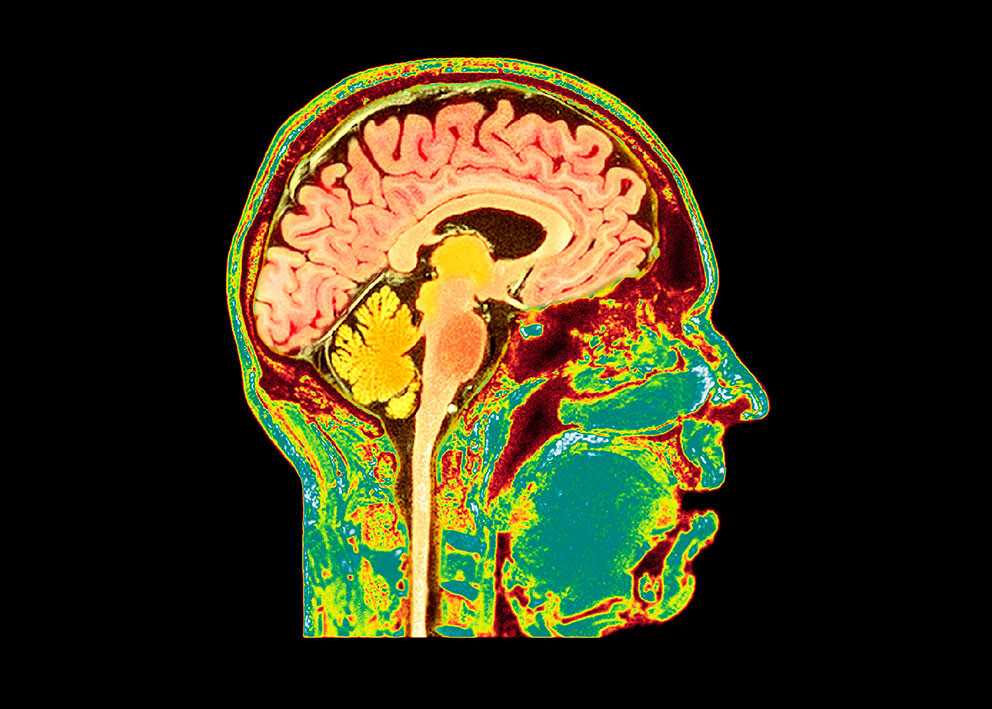 Foto: Science Photo Library / NTB