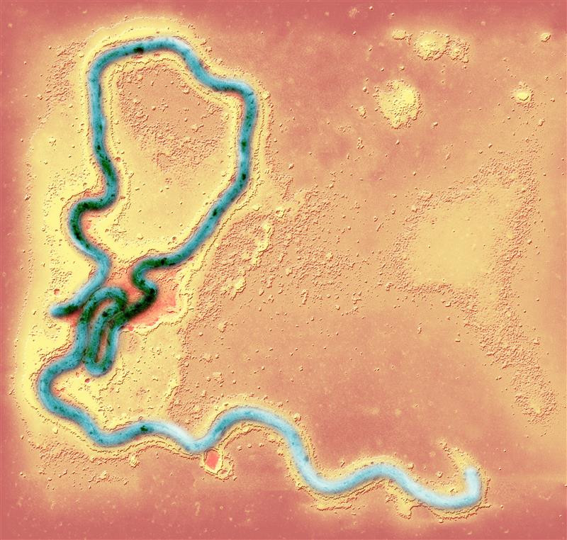 Syfilis-bakterie. Illustrasjonsfoto: Science Photo Library / NTB