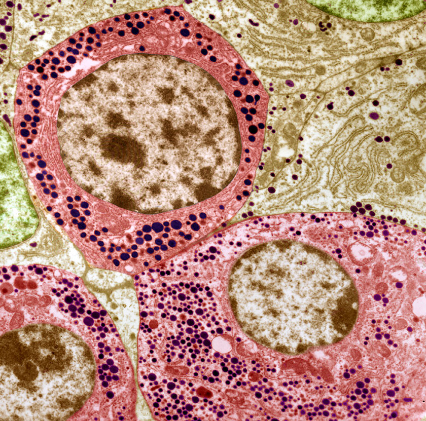 Hypofysen, farget transmisjonselektronmikroskop (TEM). Illustrasjonsfoto: Science Photo Library / NTB