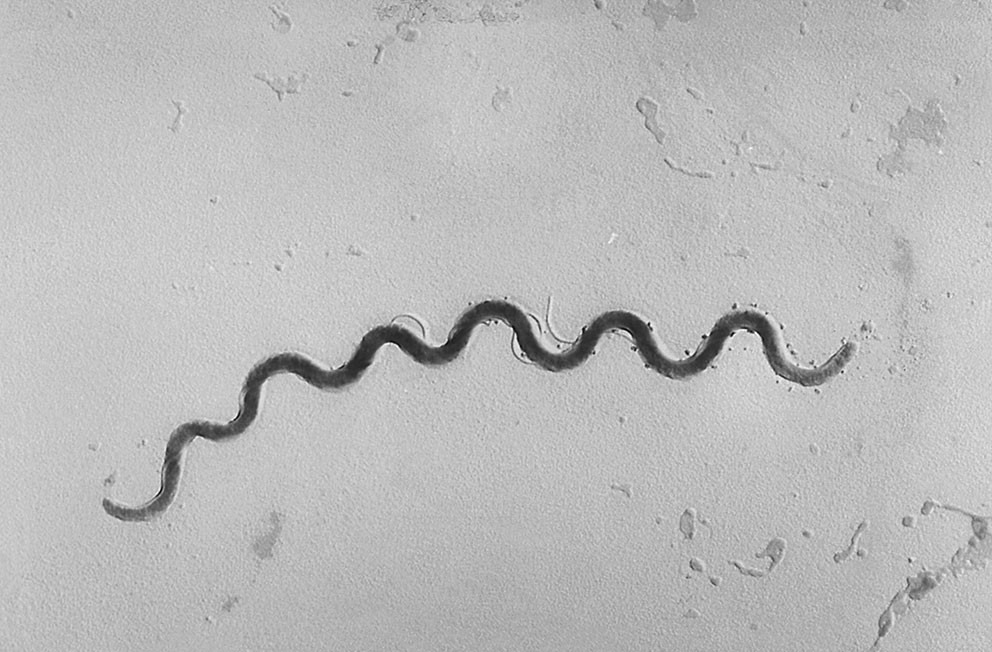 Bakterien Treponema pallidum, som for&aring;rsaker syfilis. Foto: Susan Lindsley / NTB