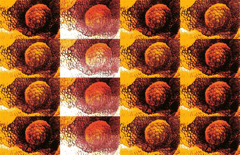 Foto: Science Photo Library / NTB. Illustrasjon av Tidsskriftet
