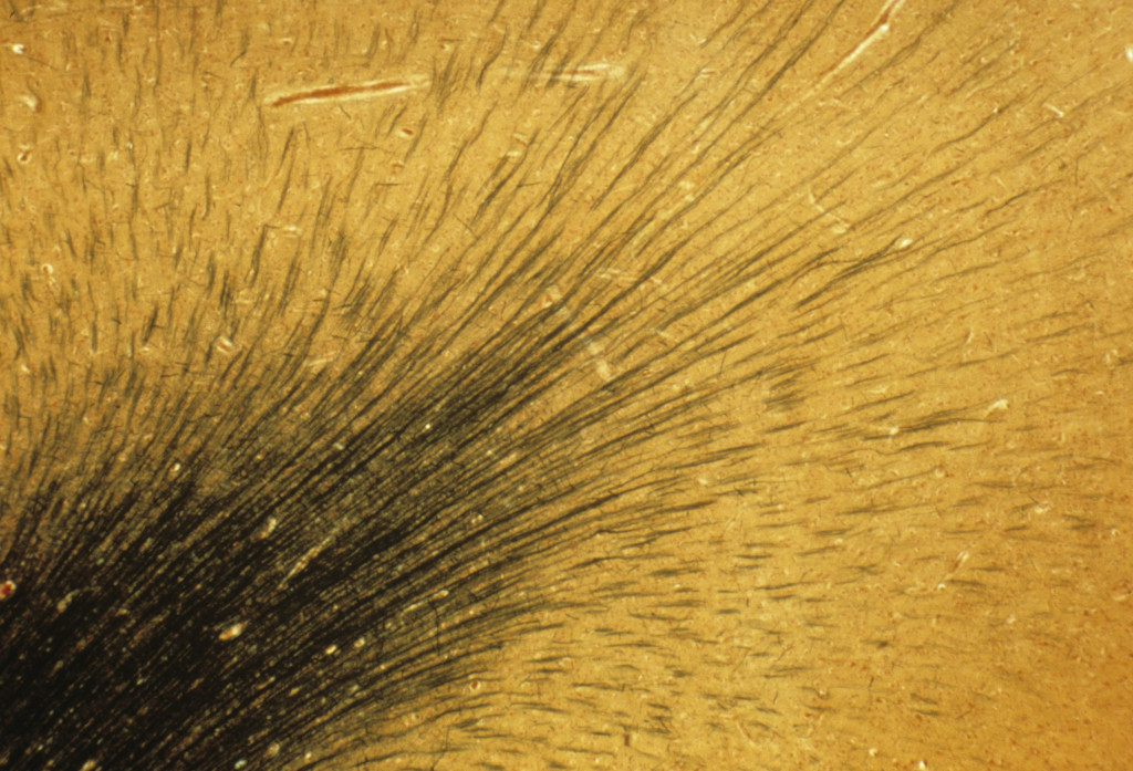 Nervefibre, lysmikrofotografi. Illustrasjonfoto: Science Photo Library / NTB