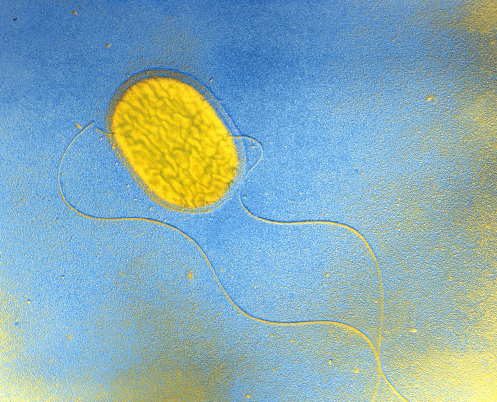Salmonella Typhimurium‑bakterie, transmisjonselektronmikroskopi. Foto: Science Photo Library / NTB