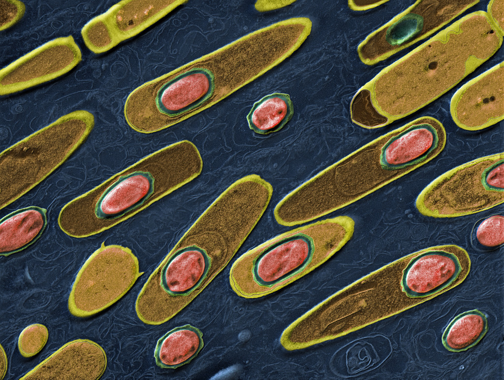 Bacillus anthracis, transmisjonselektronmikroskopi. Foto: Science Photo Library / NTB