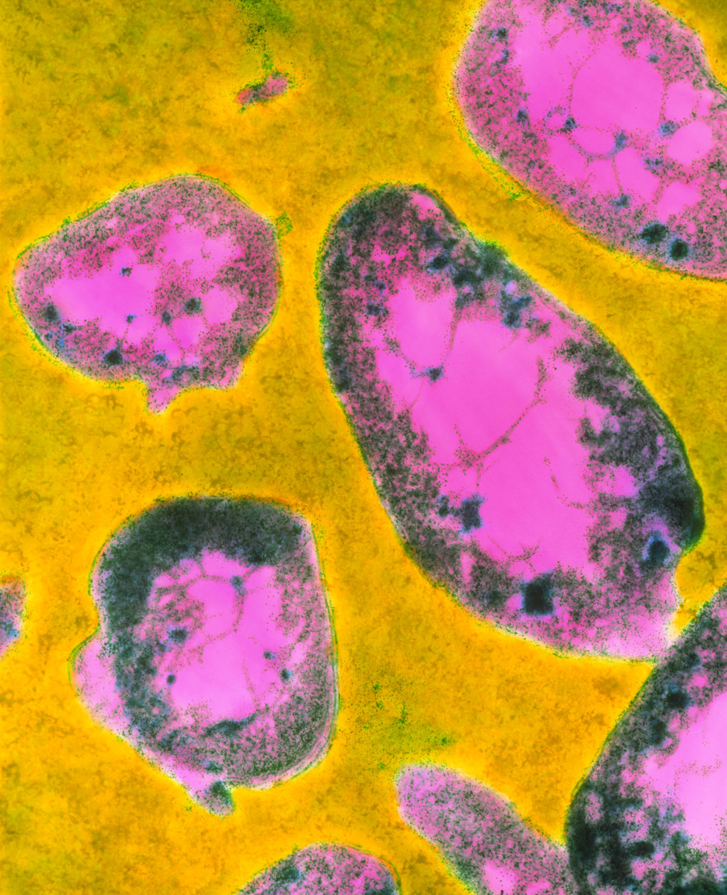 Francisella tularensis, transmisjonselektronmikroskopi. Foto: Science Photo Library / NTB