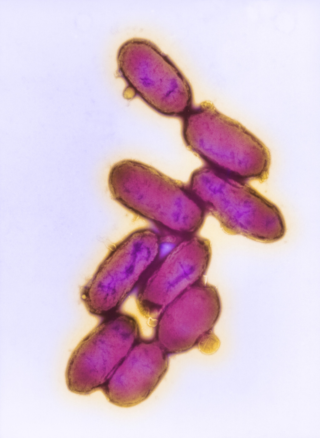 Yersinia pestis, transmisjonselektronmikroskopi. Foto: Science Photo Library / NTB