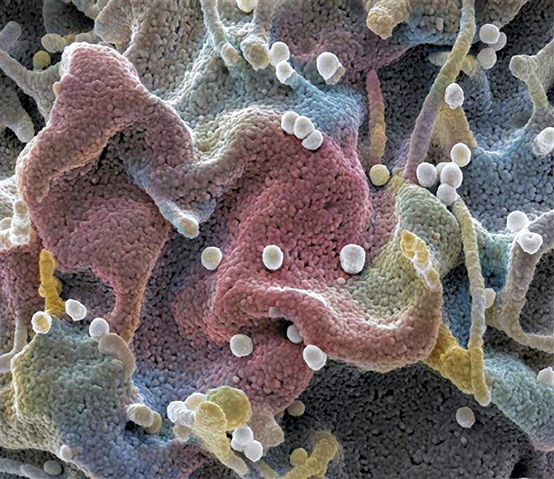 Hiv-virus, elektronmikroskopi. Illustrasjonsfoto: Science Photo Library / NTB