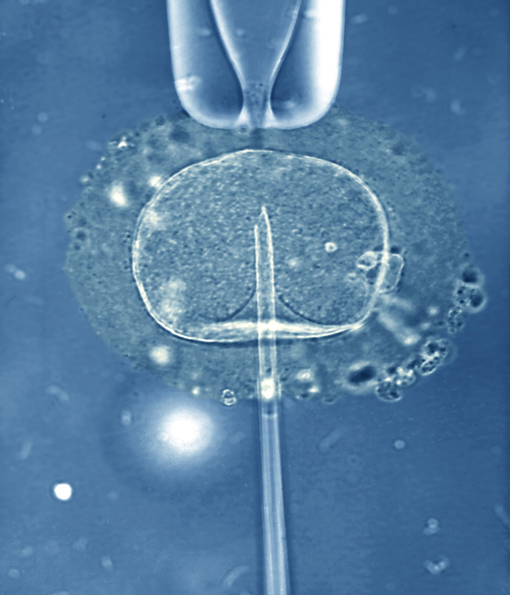 In vitro-fertilisering, lysmikroskopibilde. Illustrasjonsfoto: Science Photo Library / NTB