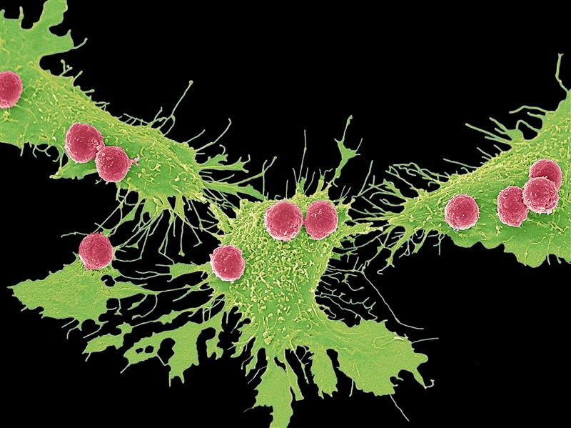 CAR-T-celle terapi, skanningelektronmikroskopibilde. Illustrasjonsfoto: Science Photo Library / NTB